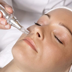 Nano-needling facial